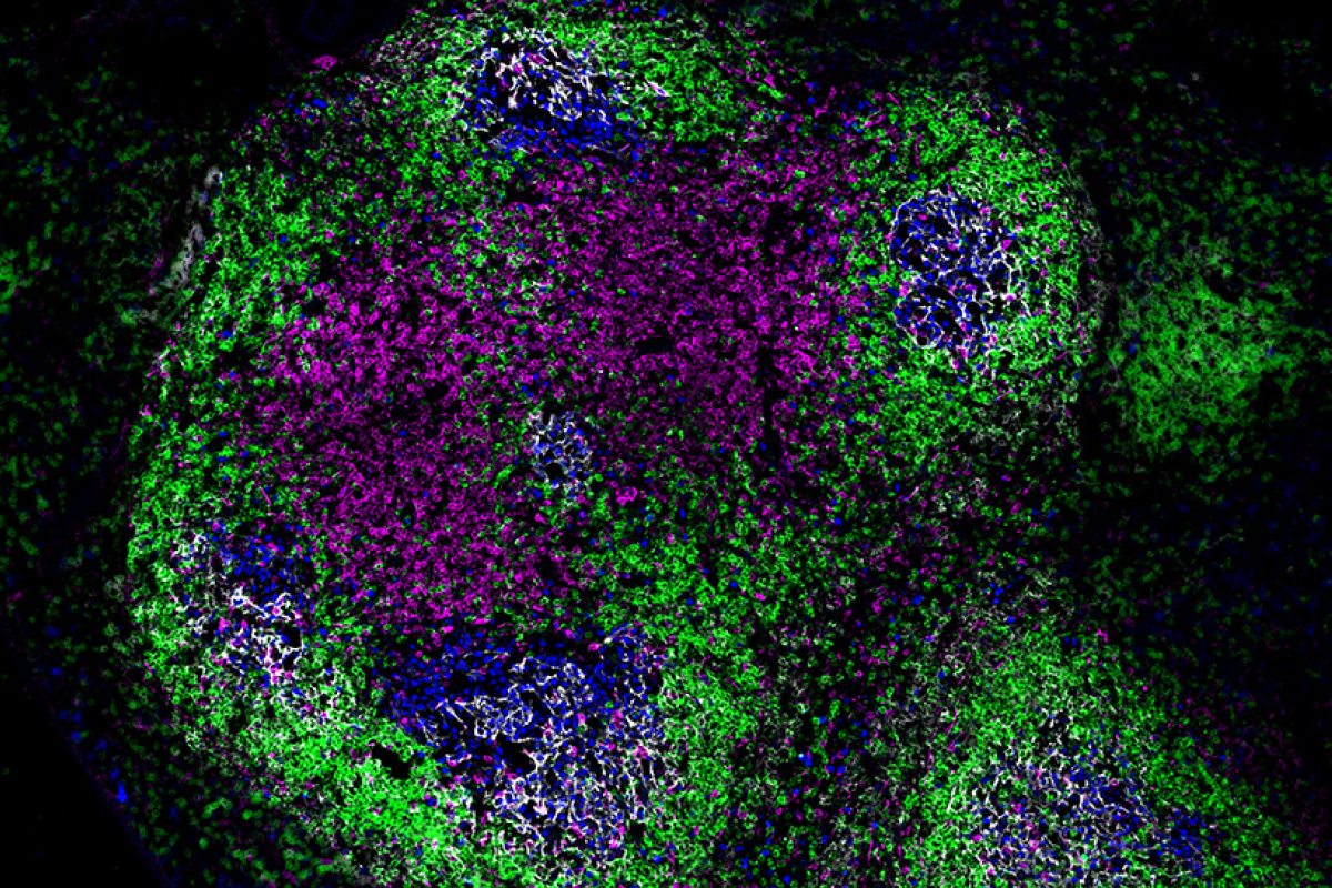Fluorescence microscopy image of germinal centres in mouse spleen