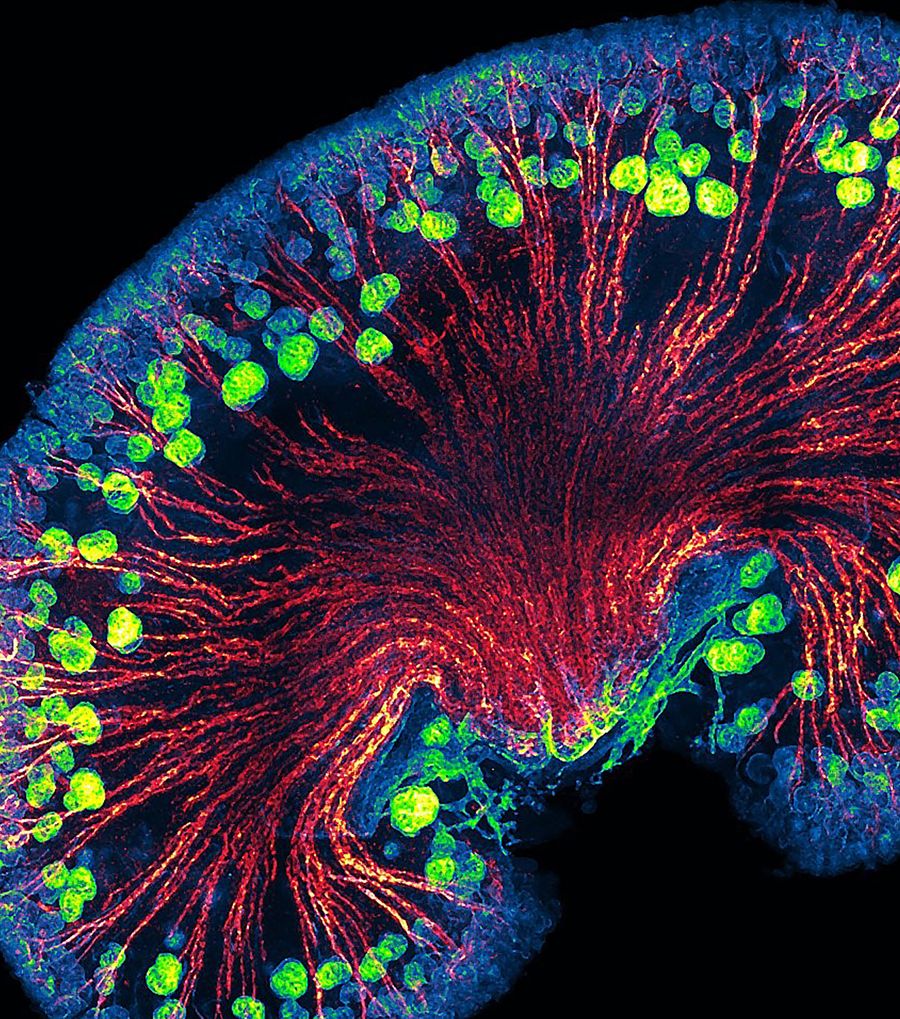 A confocal microscopy image of the urinary filtration apparatus of the developing kidney
